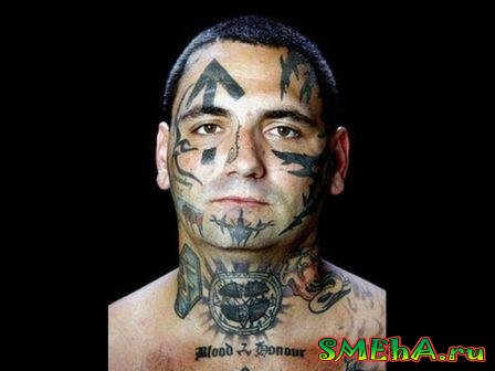 Брайон Виднер, удаление нео-нацистских татуировок с лица